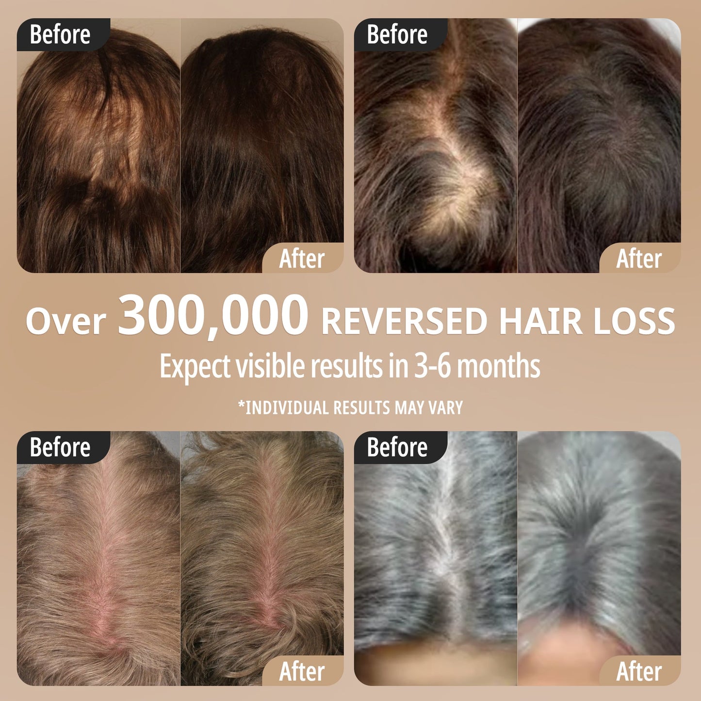 Hair Growth Scalp Massager